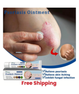 Psoriasis Dermatitis Eczema Natural Cream Skin Treatment Ointment FREE S... - $308.30 MXN