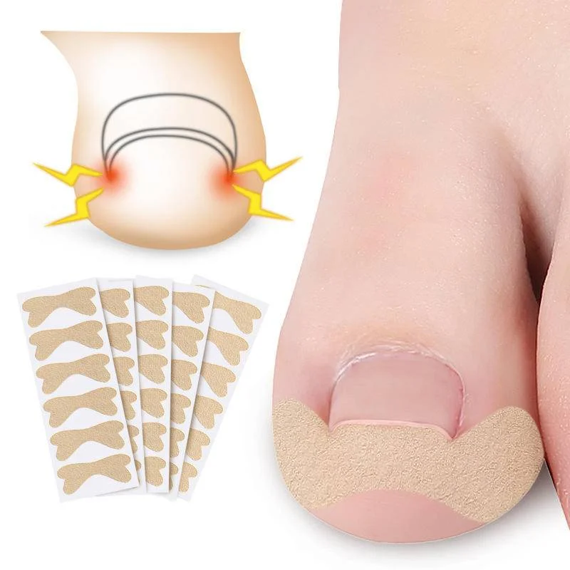 Rector toe nail sticker toenail correction free glue patch paronychia treatment recover thumb200
