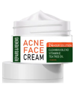  CREMA PARA EL ACNÉcrema para el acné y crema en gel para el acné,  - £10.93 GBP