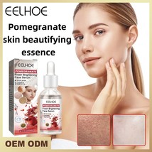 Pomegranate Skin Care Essence Facial Moisturizing Serum Shrinks Pores Brightens  - £13.04 GBP