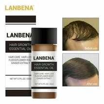 Unisex Lanbena Hair Loss Treatment Ginger Extract Hair Growth Essential ... - $164.85 MXN