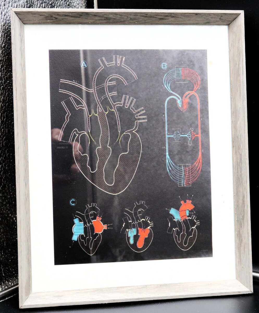 Vtg Paul Sougy The Human Heart Beautiful Print Framed Unique Educational... - $29.99