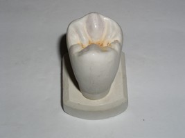 Dental Tooth Model Plaster Cast Anatomy Morphology Teaching Upper 2nd Bi... - $19.99