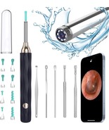 Ear Wax Removal, 1080P Ear Cleaner Camera, Ear Cleaning Kit Otoscope 6 L... - £22.05 GBP